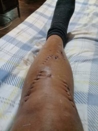 acidente criminoso de transito.jpg